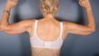 Brachioplasty 