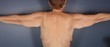 Brachioplasty 