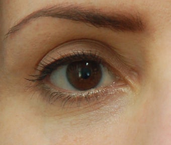 Artefill to the Orbital Rim