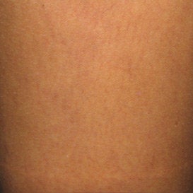Asclera