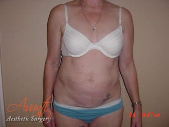 Body Jet