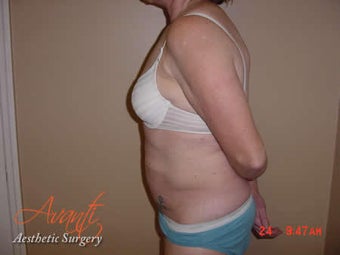 Body Jet