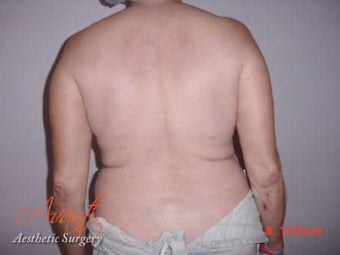 Body Jet