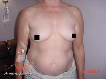 Body Jet