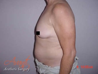 Body Jet