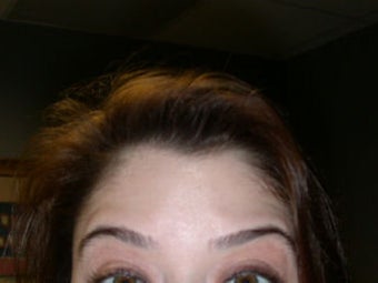 Botox