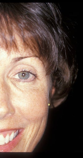 Botox
