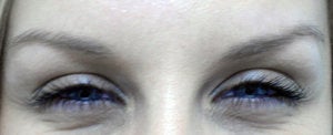 BOTOX Cosmetic