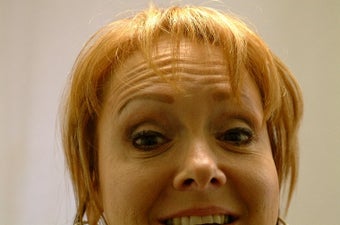Botox