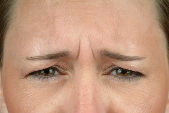 Botox