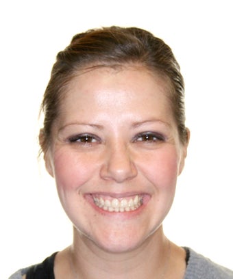 Surgical Orthodontics
