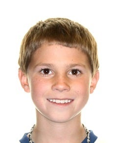 Early Orthodontic Treatment