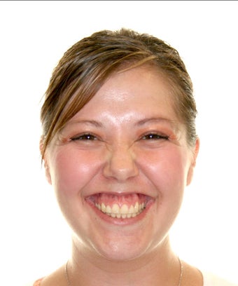 Surgical Orthodontics