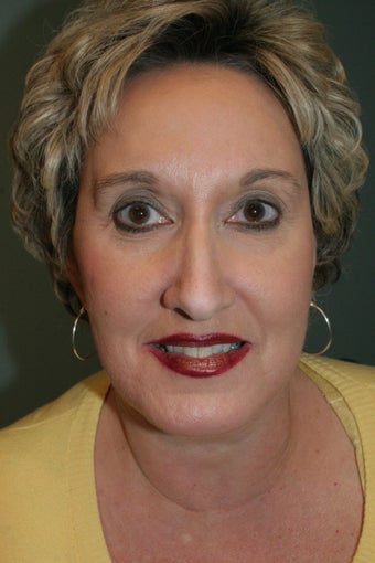 Total Facial Rejuvenation