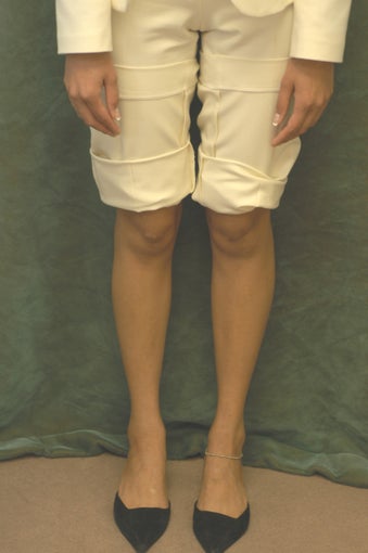 Women's Calf Augmentation 