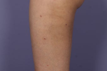 Cellulaze