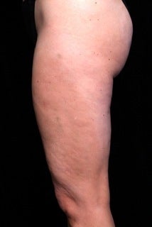Cellulaze