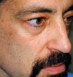 Mid facelift with tear trough implant