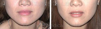 Jaw