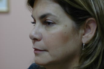 Hetter facial resurfacing