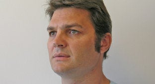 Facial Implant 