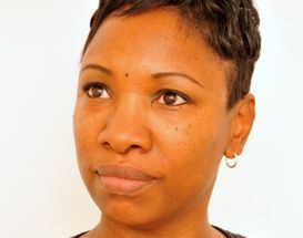 Chin Augmentation