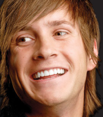 Damon System Braces