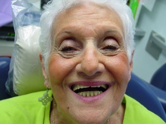 Implants 