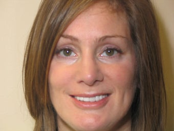 Porcelain Crowns & Bridge; Porcelain Veneers; Composite Restorations