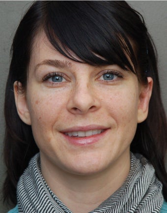 Otoplasty