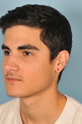 Gauged Earlobe Repair