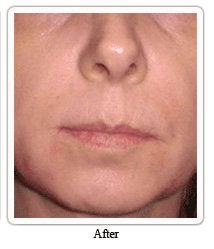 Evolence: a naturally younger-looking you