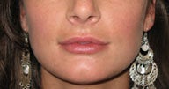 Injectables 