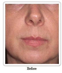 Evolence: a naturally younger-looking you