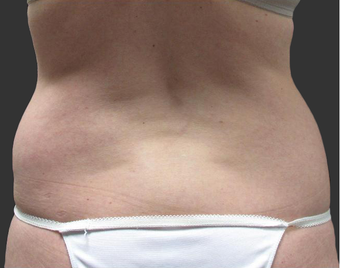 Exilis
