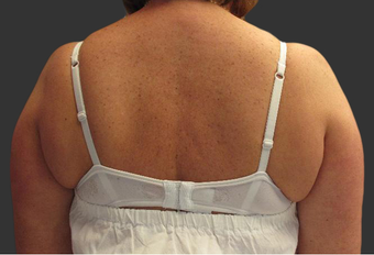 Exilis