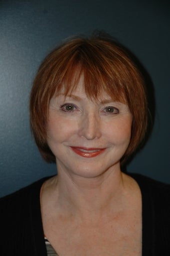 Facelift