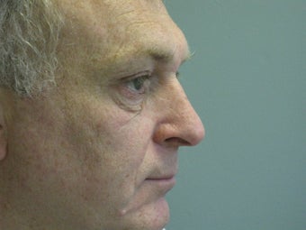 Extended lower lid blepharoplasty