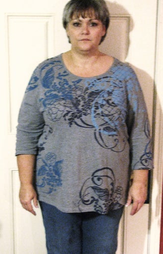 Gastric Bypass 