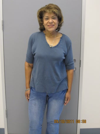 Gastric Bypass 