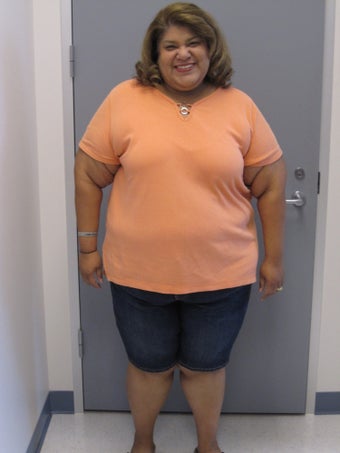 Gastric Bypass 