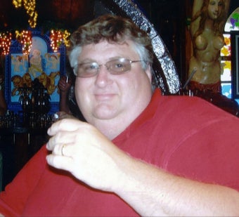 Gastric Bypass 