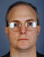 Hair Transplant