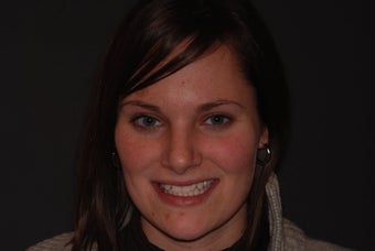 Invisalign