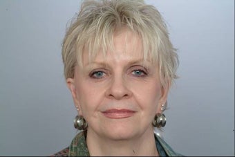 Juvederm Injection