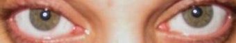 IBRITE Eye Whitening