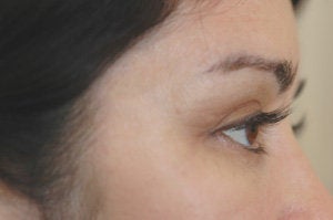 Latisse for eyelashes
