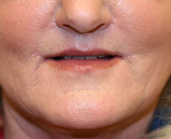Lips