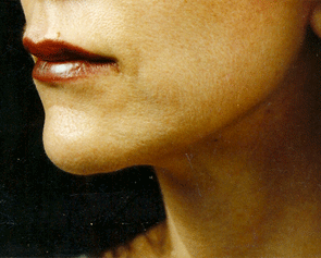 Lip Enhancement