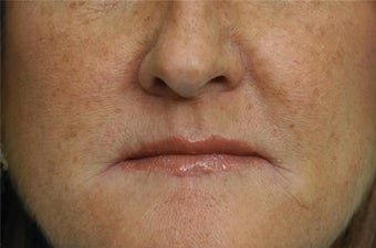 Vermillion Advance